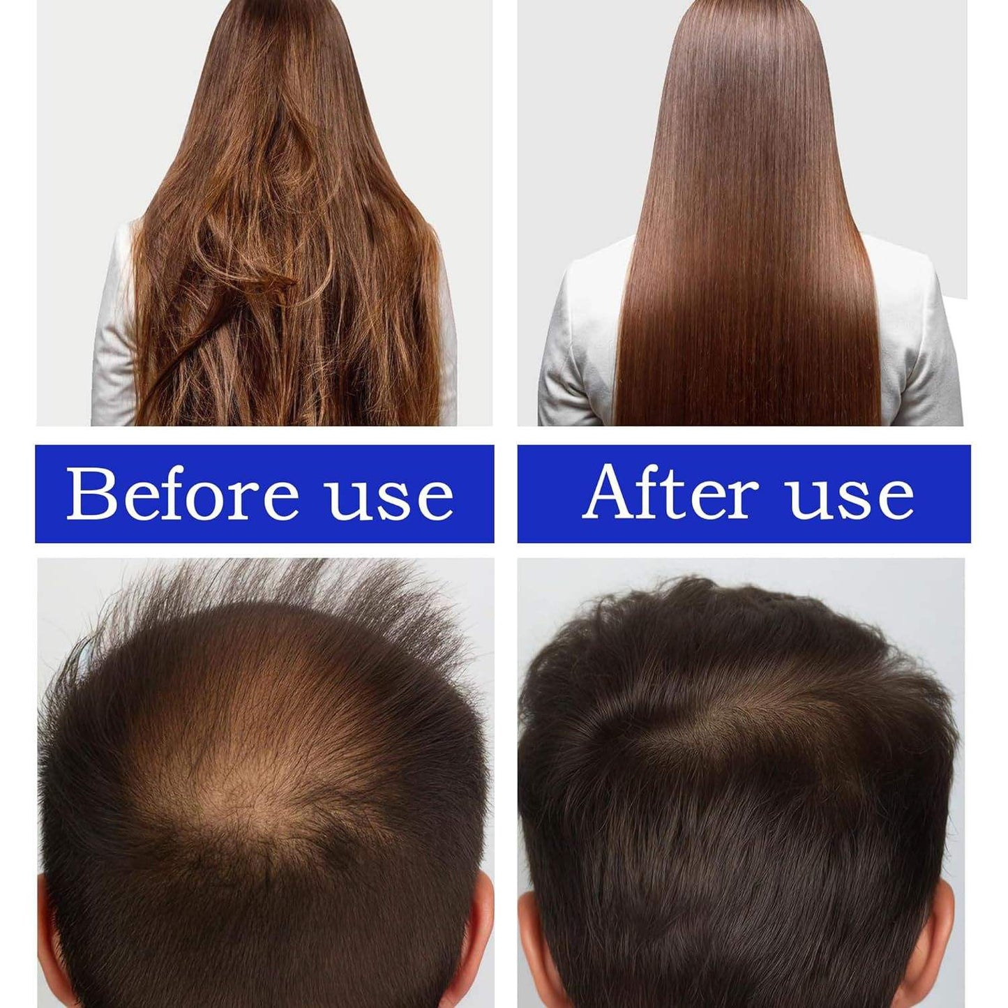 Hot Hair Growth Supplements Hair Care Essential Oil Promoting Growth Without Damage Batana Hair Oil