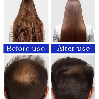 Hot Hair Growth Supplements Hair Care Essential Oil Promoting Growth Without Damage Batana Hair Oil